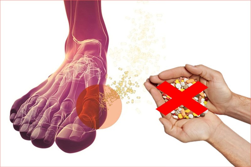 Các phương pháp chữa bệnh gout không cần dùng thuốc hiệu quả