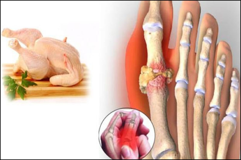 Mắc bệnh gout ăn thịt gà được không trở thành thắc mắc của nhiều người