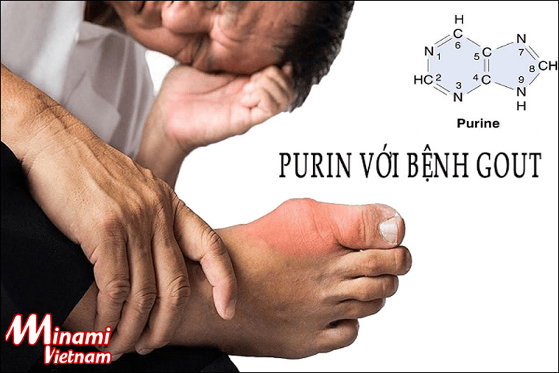 Lượng Purin có trong cơ thể ảnh hưởng đến sức khỏe ra sao?