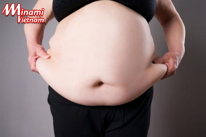 Bệnh béo phì được định nghĩa như thế nào?