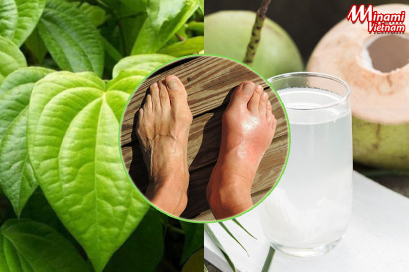 Bài thuốc chữa gout thứ nhất với nước dừa và lá trầu