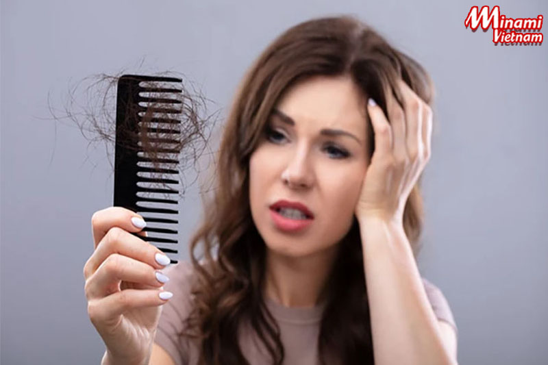 Căng thẳng và stress khiến bạn rụng tóc