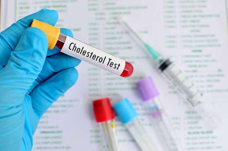 Biết được hàm lượng Cholesterol trong cơ thể sẽ giúp bạn bảo vệ sức khoẻ tốt hơn
